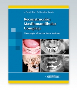 Reconstrucción Maxilomandibular Compleja Microcirugía. Edición 2013. Naval