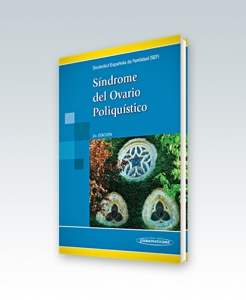 Síndrome del Ovario Poliquístico. Segunda Edición – 2013. SEF, Checa