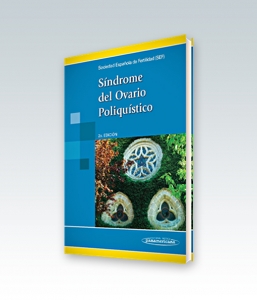 Síndrome del Ovario Poliquístico. Segunda Edición – 2013. SEF, Checa