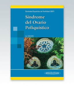 Síndrome del Ovario Poliquístico. Segunda Edición – 2013. SEF, Checa