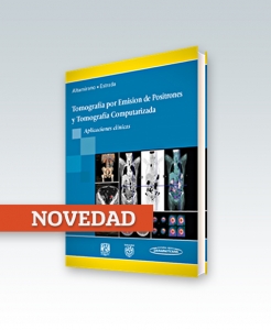 Tomografía por Emisión de Positrones y Computarizada. Ed. 2014.