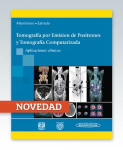 Tomografía por Emisión de Positrones y Computarizada. Ed. 2014.