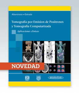 Tomografía por Emisión de Positrones y Computarizada. Ed. 2014.