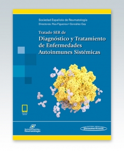 Tratado SER de Diagnóstico y Tratamiento de Enfermedades Autoinmunes Sistémicas (Incluye versión digital)