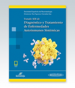 Tratado SER de Diagnóstico y Tratamiento de Enfermedades Autoinmunes Sistémicas (Incluye versión digital)