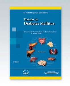 Tratado de Diabetes Mellitus – 2ª Edición