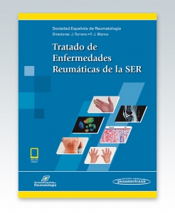 Tratado de Enfermedades Reumáticas de la SER (incluye versión digital)