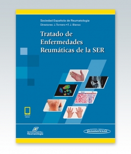 Tratado de Enfermedades Reumáticas de la SER (incluye versión digital)