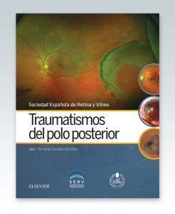 SERV, Traumatismos del polo posterior + acceso web © 2016