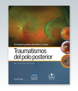 SERV, Traumatismos del polo posterior + acceso web © 2016