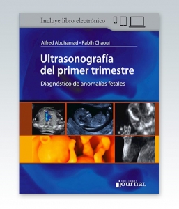 Ultrasonografía del primer trimestre – 2020