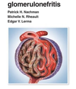 Manual de glomerulonefritis. 1ª Edición – 2024