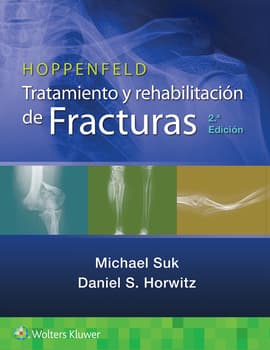 Hoppenfeld. Tratamiento y rehabilitación de fracturas. 2ª Edición
