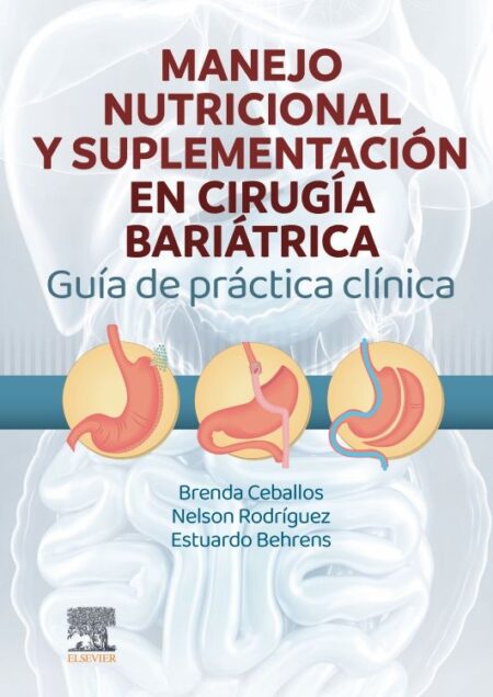 Manejo Nutricional y Suplementación en Cirugía Bariátrica. 1ª Edición