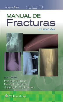 Manual de fracturas 6.ª ed.