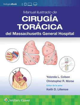 Manual ilustrado de Cirugía torácica del Massachusetts General Hospital