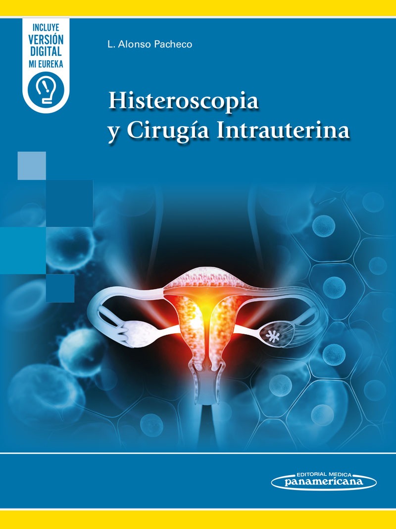 Histeroscopia y Cirugía Intrauterina. Incluye eBook 1.ª ed