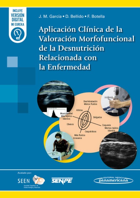 Aplicación Clínica de la Valoración Morfofuncional de la Desnutrición Relacionada con la Enfermedad. 1ª. Incluye eBook
