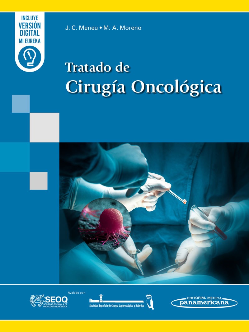 Tratado de Cirugía Oncológica. 1ª. Incluye eBook.