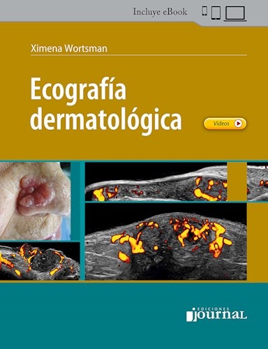 Ecografía Dermatológica. Incluye eBook