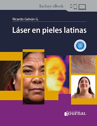 Láser en pieles latinas. Incluye eBook