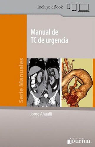 Manual de TC de Urgencia - Serie Manuales. Incluye eBook