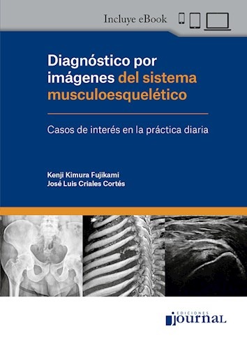Diagnóstico por Imágenes del sistema musculoesquelético. Incluye eBook