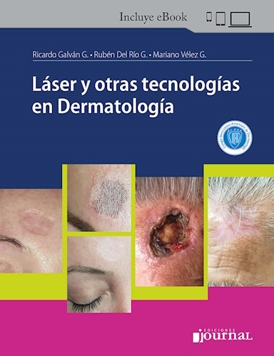 Láser y otras tecnologías en Dermatología. Incluye eBook
