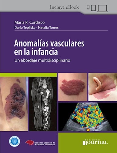 Anomalías vasculares en la infancia: Un abordaje multidisciplinario. Incluye eBook