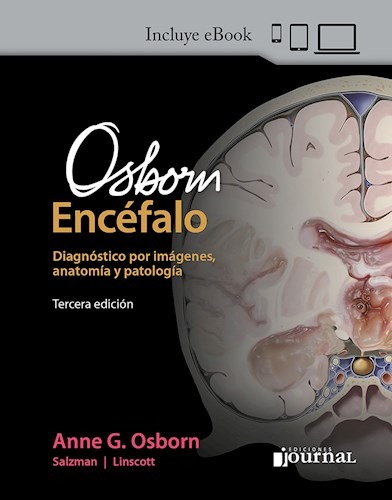 Osborn. El Encéfalo. Incluye eBook