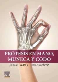 Prótesis en mano, muñeca y codo. 1ª Ed.