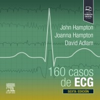 160 casos de ECG. 6ª Ed.