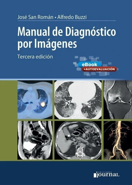 Manual de Diagnóstico por Imágenes. 3ª Ed. Incluye eBook