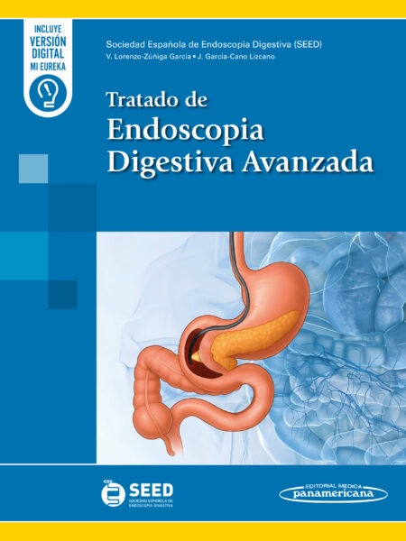 Tratado de Endoscopia Digestiva Avanzada. 1ª Ed. Incluye eBook